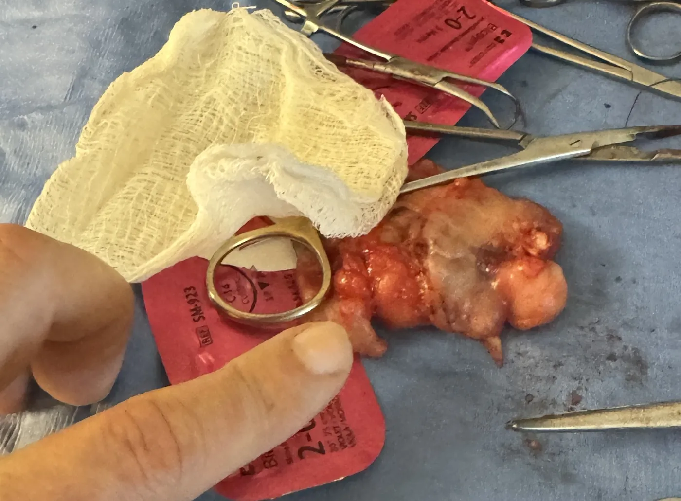 Full canine ovary removed through a small laparoscopic incision, shown next to a ring for scale